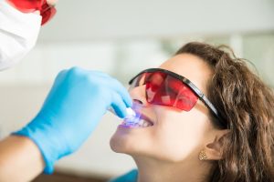 Importancia y avances en el blanqueamiento dental una tendencia creciente en cuidado bucal